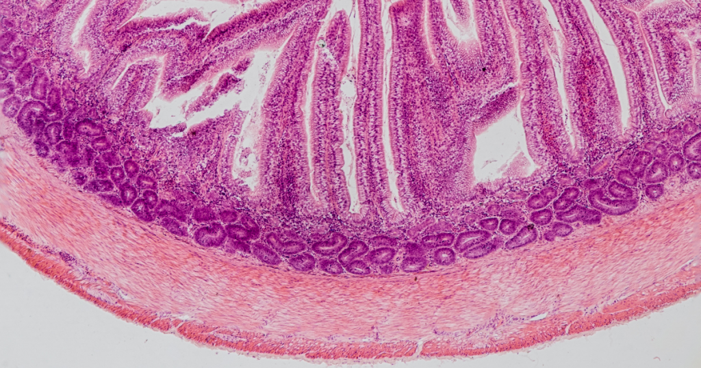 Tessuto dell'intestino umano - Blog